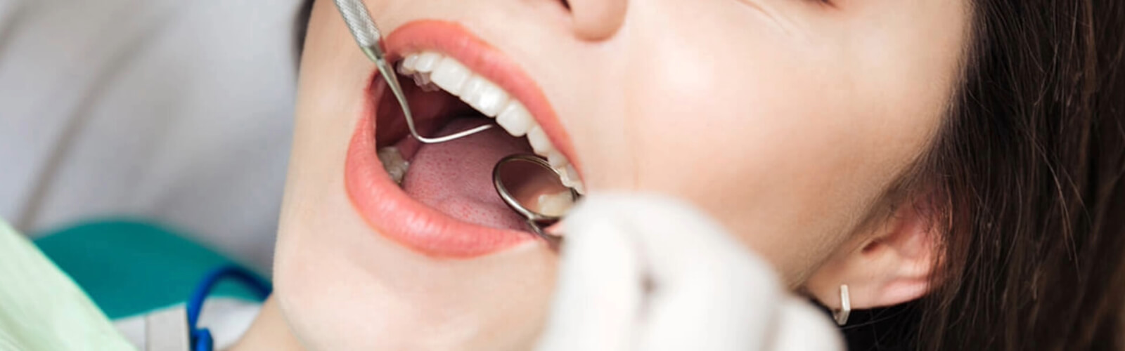 Teeth Replacement Options Caledon